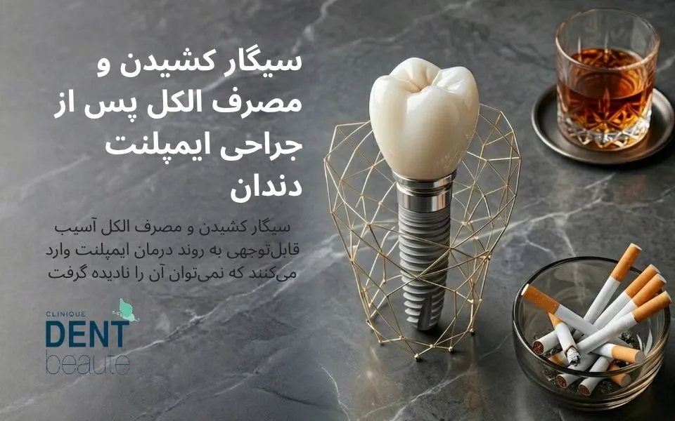 سیگار کشیدن و مصرف الکل پس از جراحی ایمپلنت دندان