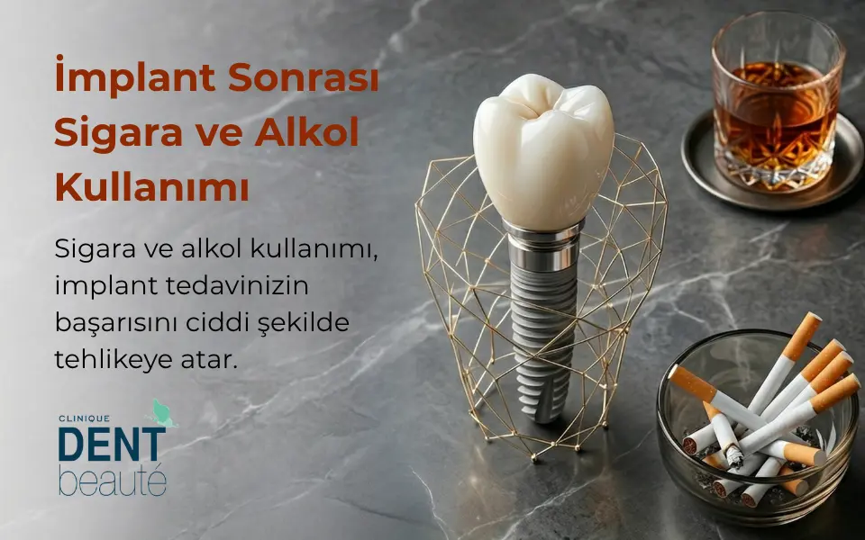İmplant Sonrası Sigara ve Alkol Kullanımı, Yorumlar