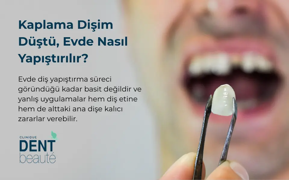 Kaplama Dişim Düştü Evde Nasıl Yapıştırılır? Ne Yapmalı? En Çok Yapılan Hatalr Nelerdir?